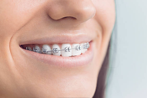 Full Mouth Reconstruction in Redwood, TX